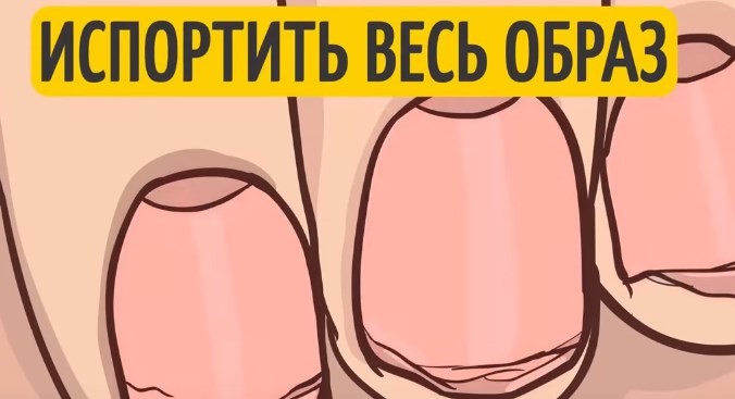 Слишком толстые слои лака на ногти ногти тут