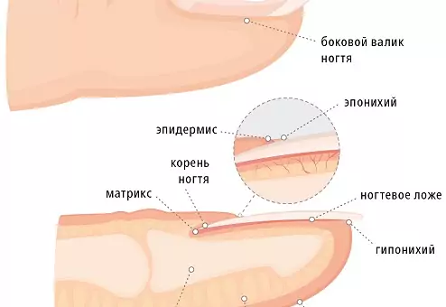 Заболевания ногтей