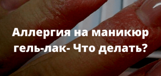 Аллергия на маникюр гель-лак - Что делать?