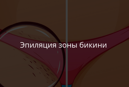 Эпиляция зоны бикини