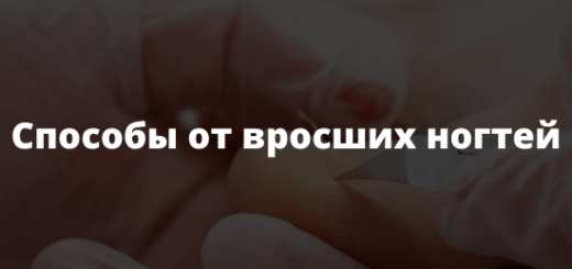 Способы от вросших ногтей