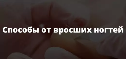 Способы от вросших ногтей