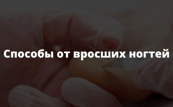 Способы от вросших ногтей