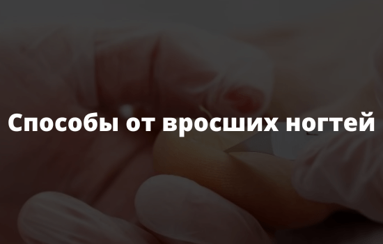 Способы от вросших ногтей