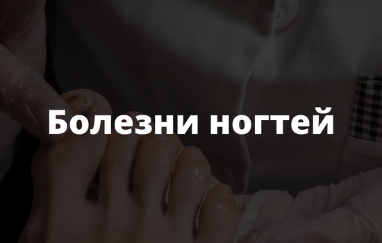 Болезни ногтей
