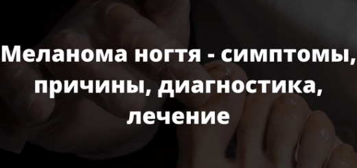 Меланома ногтя - симптомы причины диагностика лечение