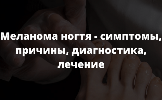 Меланома ногтя - симптомы причины диагностика лечение