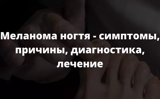 Меланома ногтя - симптомы причины диагностика лечение