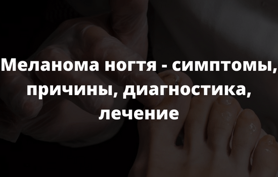Меланома ногтя - симптомы причины диагностика лечение